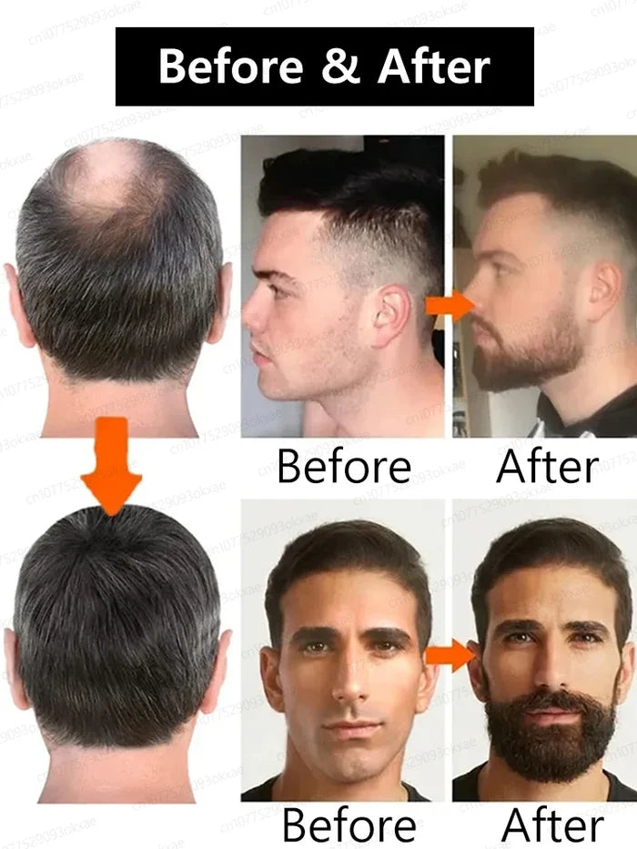 StyleBeard Boost